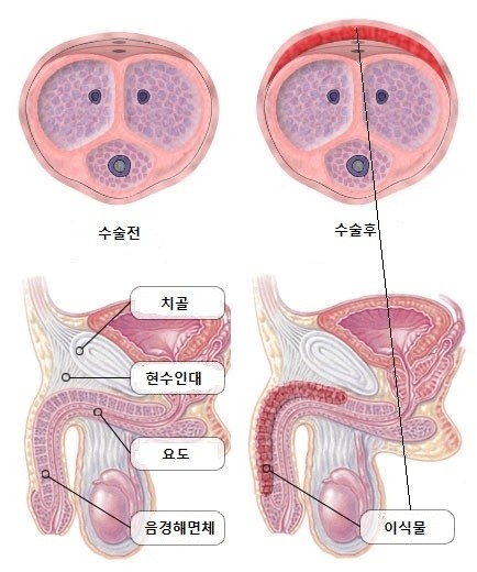 명동 준비뇨기과/중구 을지로 명동 준비뇨기과/중구 을지로