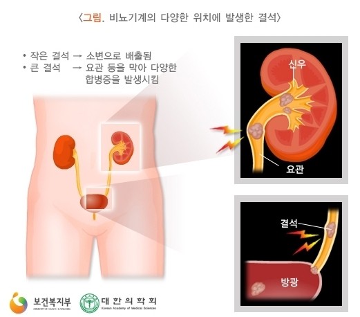 강필 비뇨의학과 의원 강필 비뇨의학과 의원