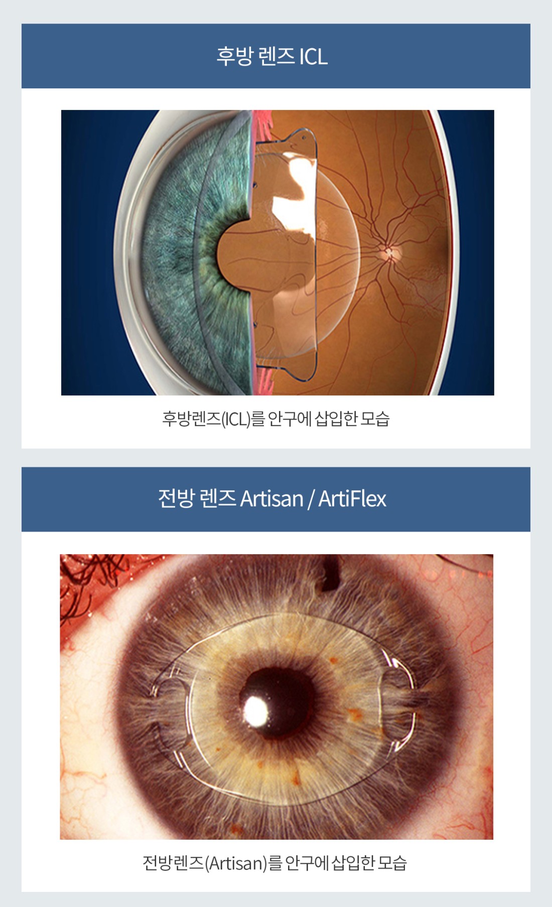 서귀포연세안과