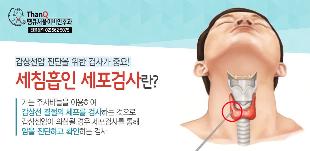 갑상선 세침 검사의 통증과 조직 검사의 비용은? 갑상선 오물오물 조직검사전문병원 강서구 발산역