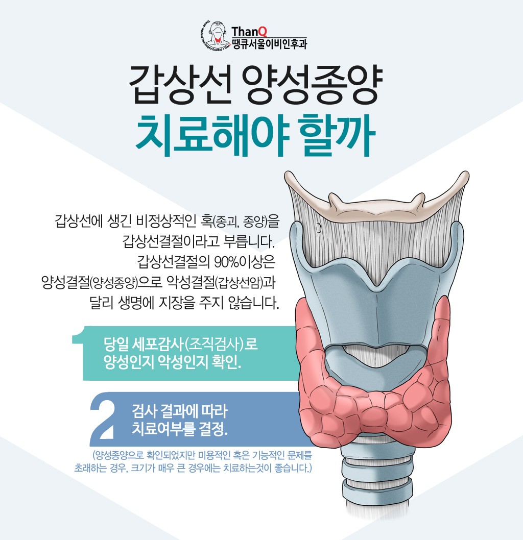 갑상선 혹은 암일까? 결절 치료에 대해