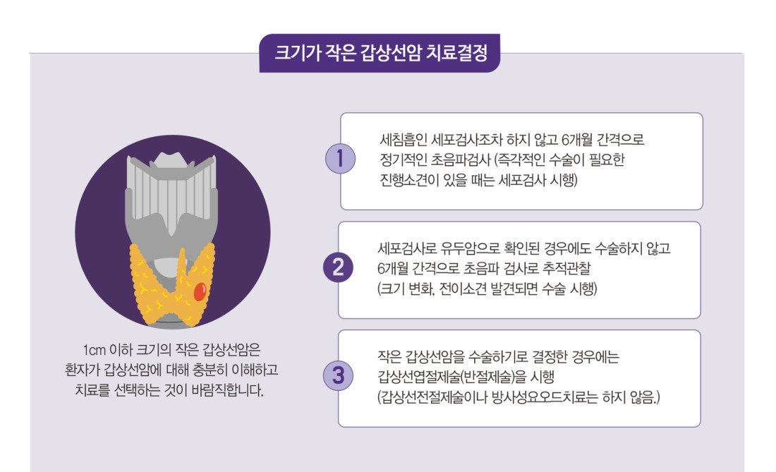 갑상선암치료 전 갑상선암검사 필요한 이유