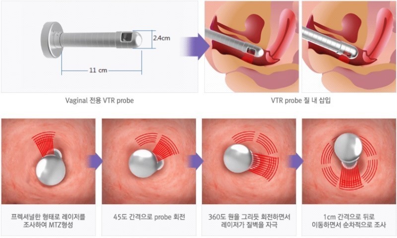 강남선릉3번 클렌시아성형피부 강남선릉3번 클렌시아성형피부