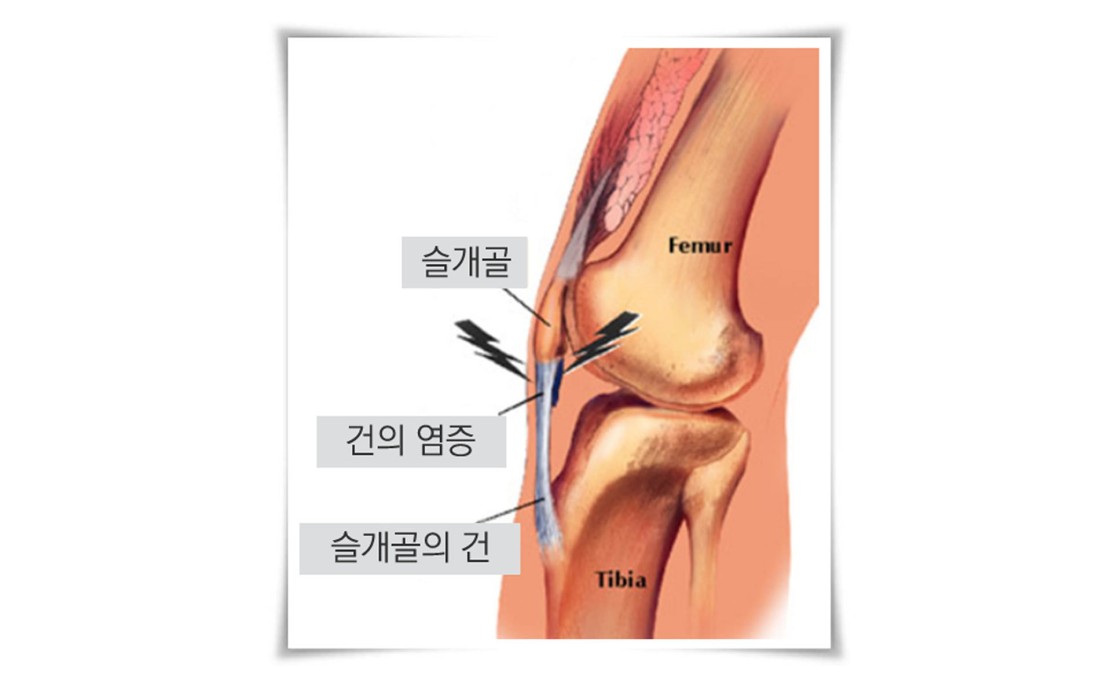 한양으뜸통증의학과