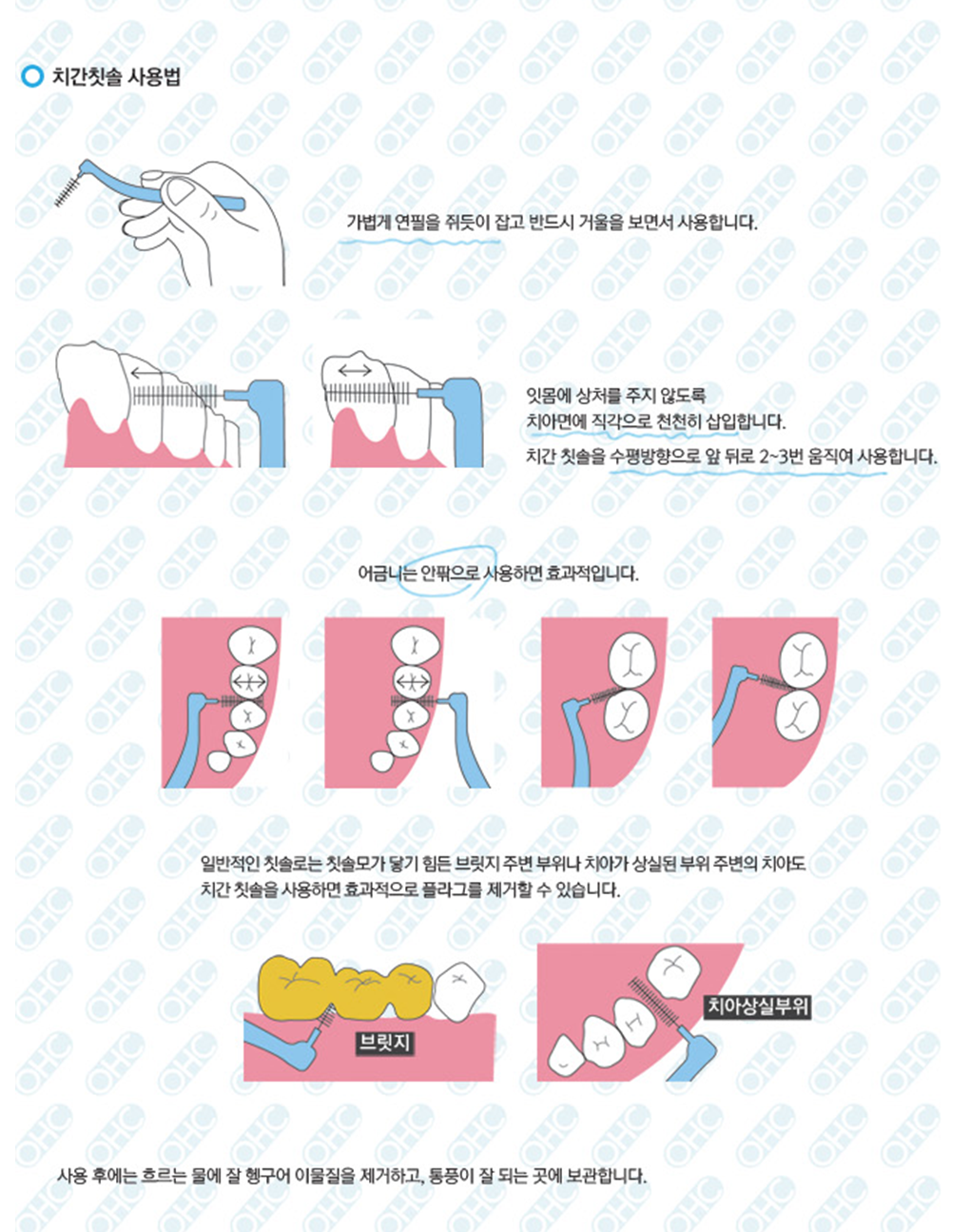 치간칫솔 사용법 | ohc칫솔샵 치간칫솔 사용법 | Ohc칫솔샵