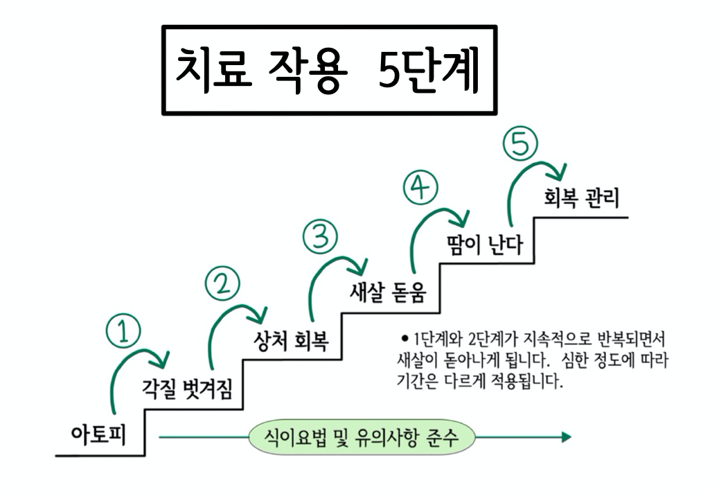 민감한 표피를 진정시키는 수원 아토피 치료 과정 8