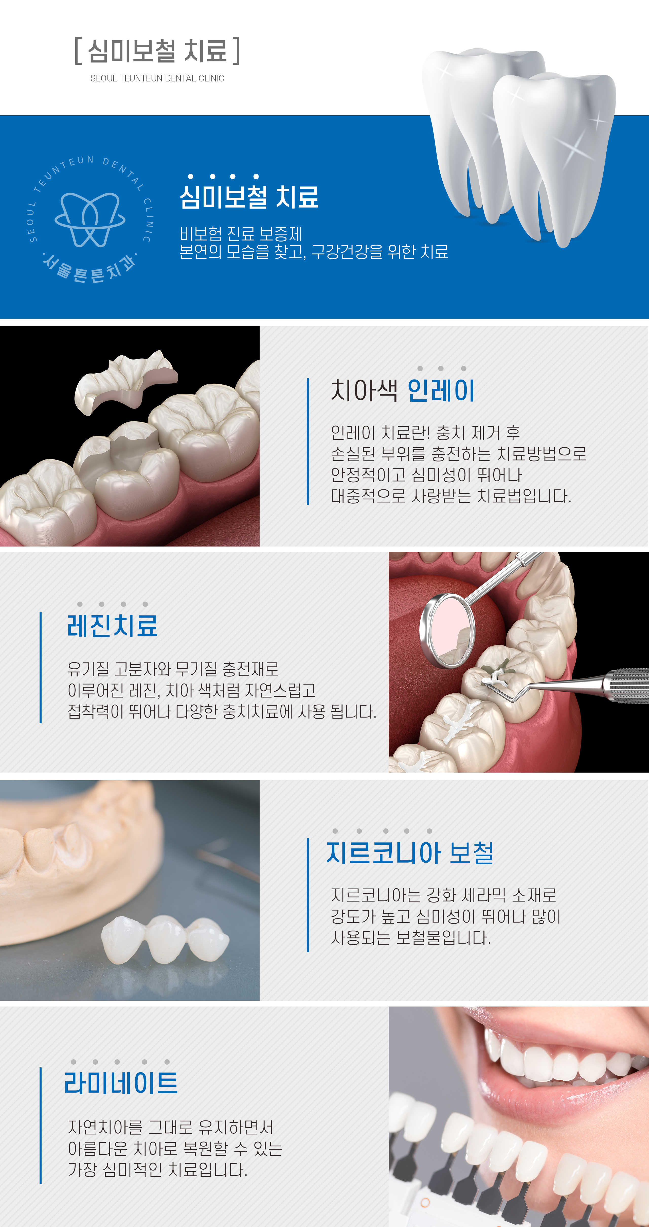 심미보철 치료-서울튼튼치과의원